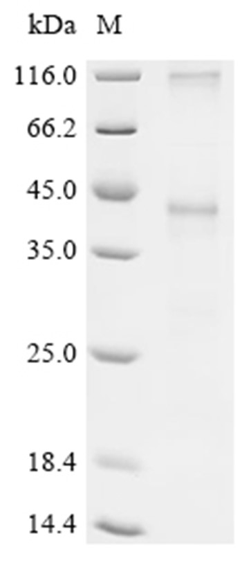 MRGPRX2 Protein, Human, Recombinant (His)