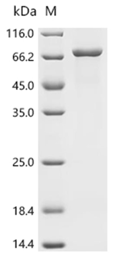 PCK1 Protein, Human, Recombinant (His)