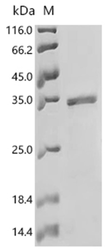 FimA Protein, E. coli, Recombinant (His & SUMO)