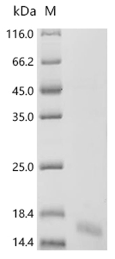 RETNLB Protein, Human, Recombinant (His)