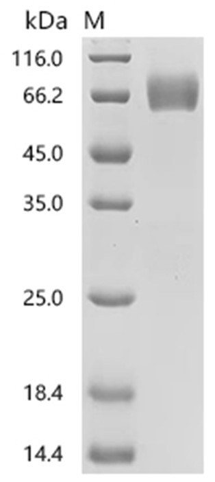 PTBP1 Protein, Human, Recombinant (His)