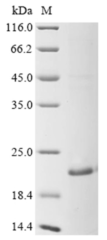 Mucin-5B/MUC5B Protein, Human, Recombinant (His & Myc)