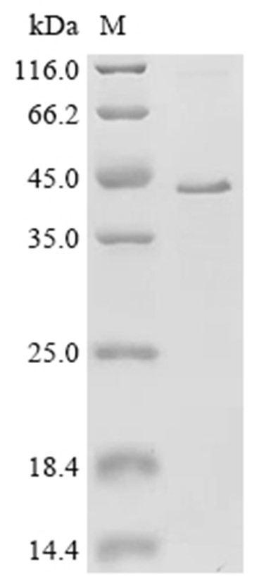 SPRY2 Protein, Human, Recombinant (His & Myc)