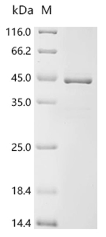 MMP-7 Protein, Human, Recombinant (GST)