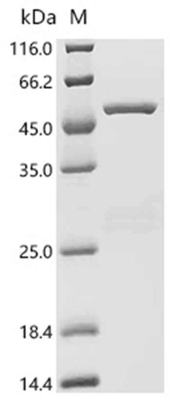 GSTK1 Protein, Human, Recombinant (GST)
