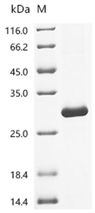 Cathepsin K Protein, Rat, Recombinant (His)