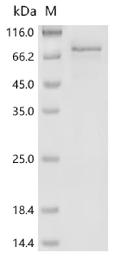 METTL3 Protein, Human, Recombinant (His)