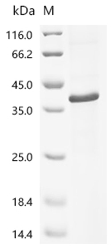 Wnt3a Protein, Mouse, Recombinant (His)