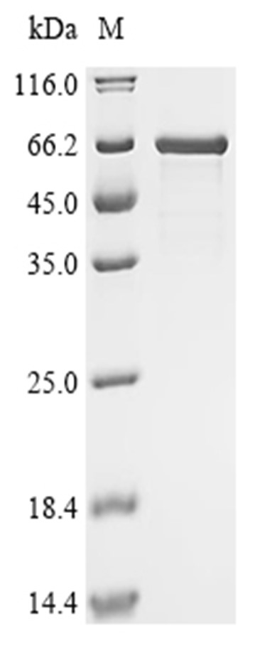 BoNT/A Protein, Clostridium botulinum, Recombinant (His & SUMO)