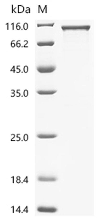 CYPOR Protein, Human, Recombinant (GST)