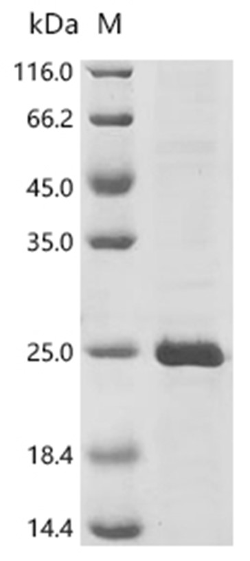 CTAG1A Protein, Human, Recombinant (His)