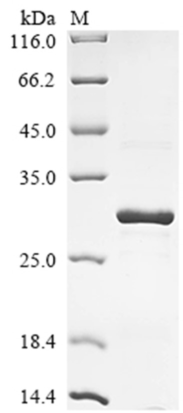 Sortase A Protein, S. aureus, Recombinant (His)