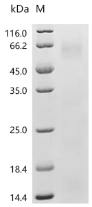 EIF2AK2 Protein, Human, Recombinant (His)