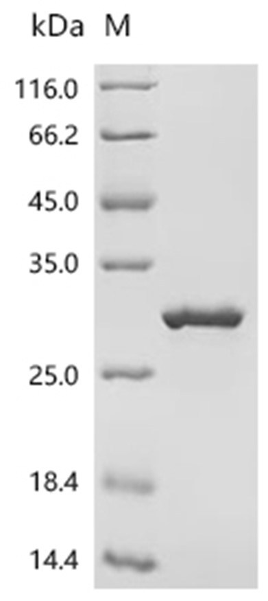OmpA Protein, Klebsiella pneumoniae, Recombinant (His & Myc)