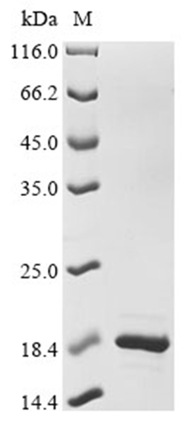 DBI Protein, Mouse, Recombinant (His & Myc)