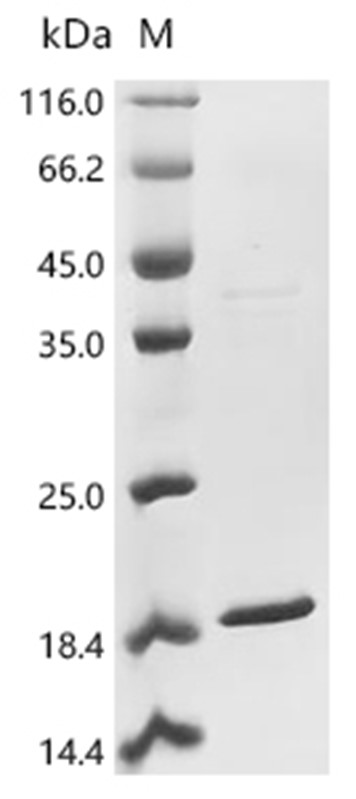 SCD1 Protein, Mouse, Recombinant (His & Myc)