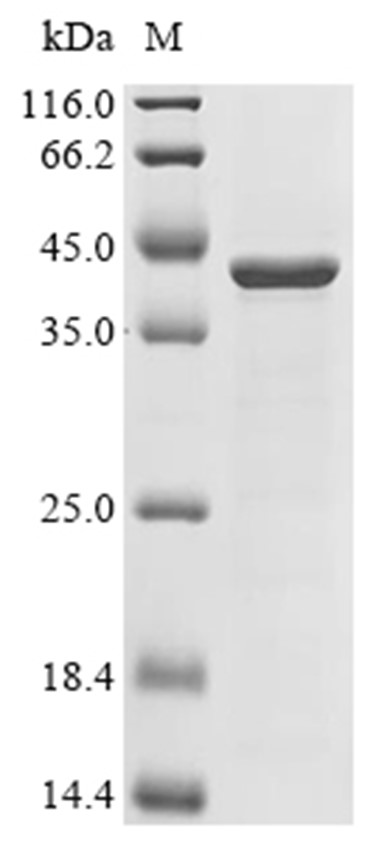 OmpK36 Protein, Klebsiella pneumoniae, Recombinant (His)