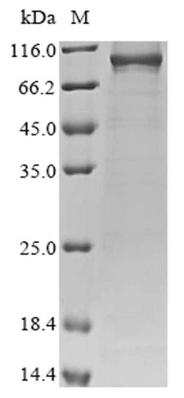 EEF2 Protein, Human, Recombinant (His)