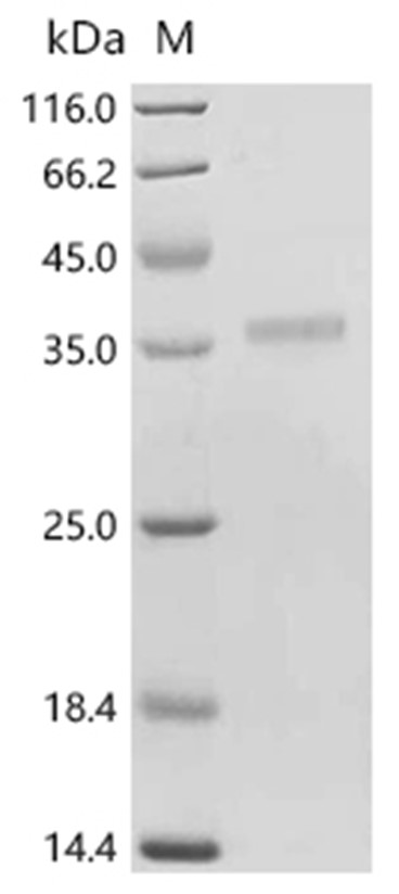 SPSB1 Protein, Human, Recombinant (His)