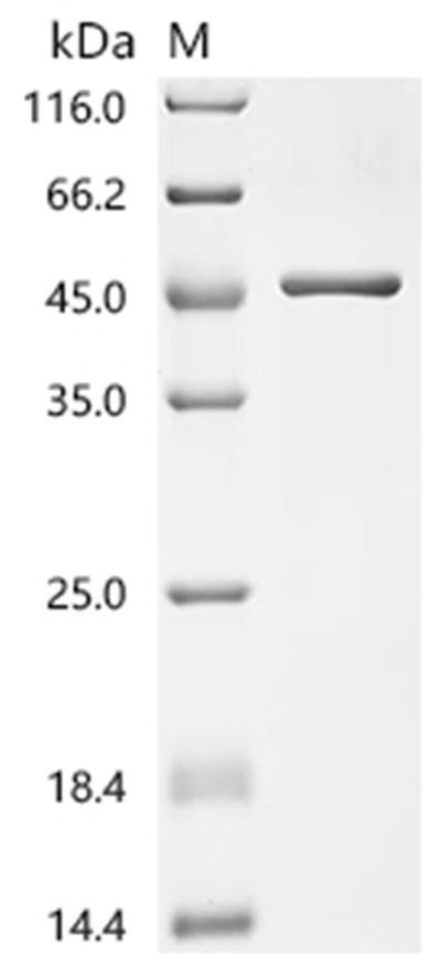 TEAD2 Protein, Human, Recombinant (His & Myc)