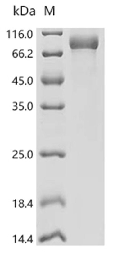 RPGR Protein, Human, Recombinant (hFc)