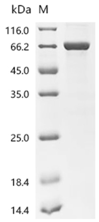 KRT7 Protein, Human, Recombinant (His & SUMO)
