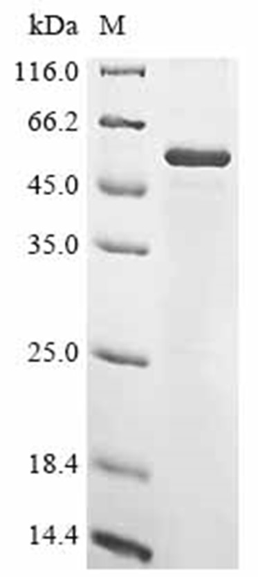 Fibrinogen beta chain Protein, Human, Recombinant (His)