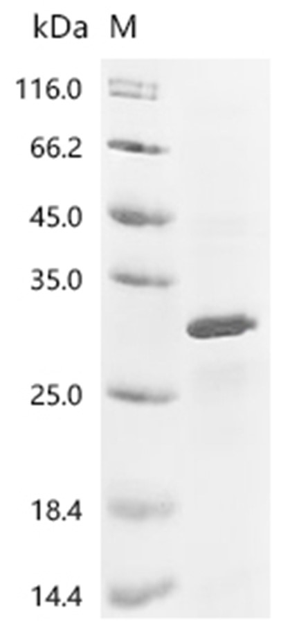 HDAC7 Protein, Human, Recombinant (His)