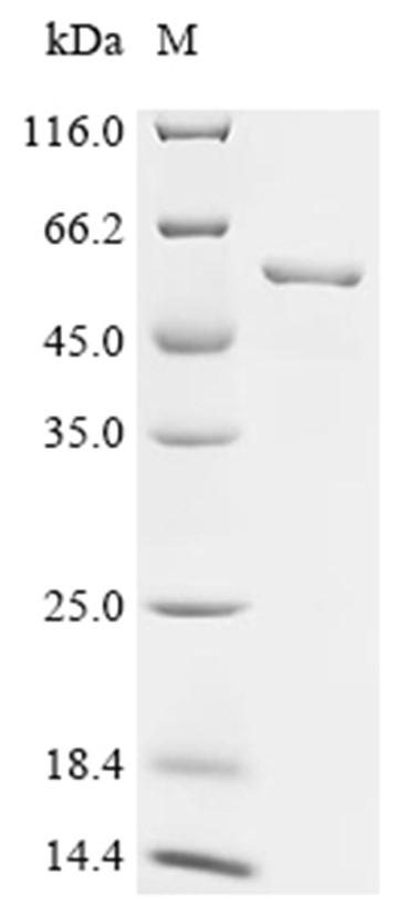 Asporin Protein, Human, Recombinant (His & SUMO)