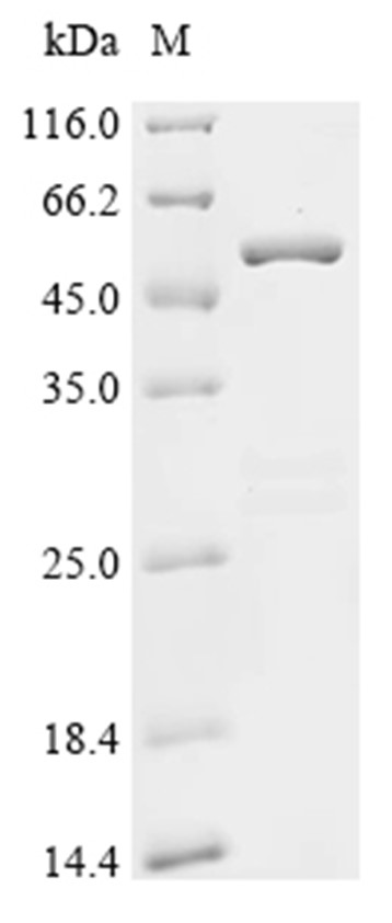 Enterotoxin type B Protein, S. aureus, Recombinant (GST)
