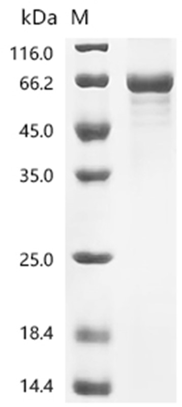 TRIM65 Protein, Human, Recombinant (His)