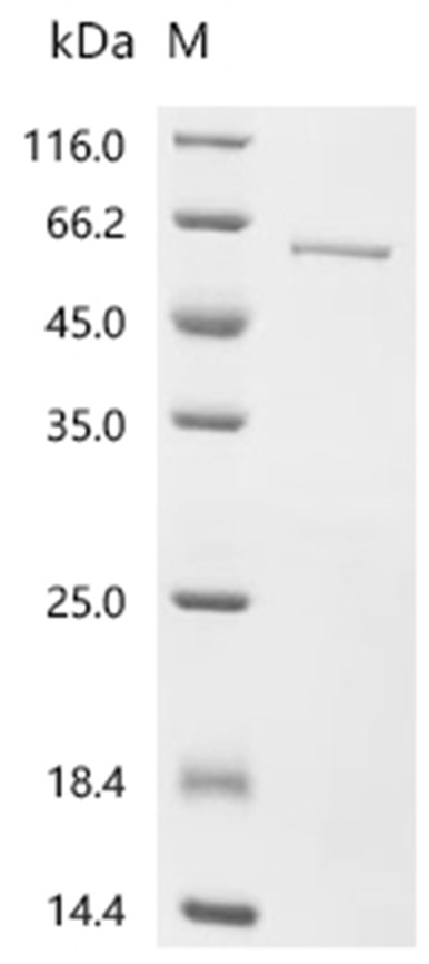 MAOB Protein, Human, Recombinant (His)
