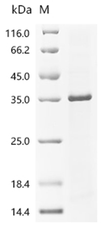 MYD88 Protein, Human, Recombinant (His)