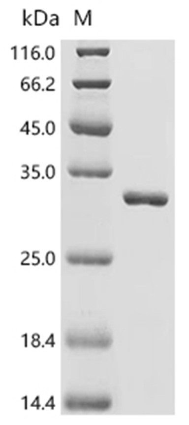 TMSB10 Protein, Human, Recombinant (GST)