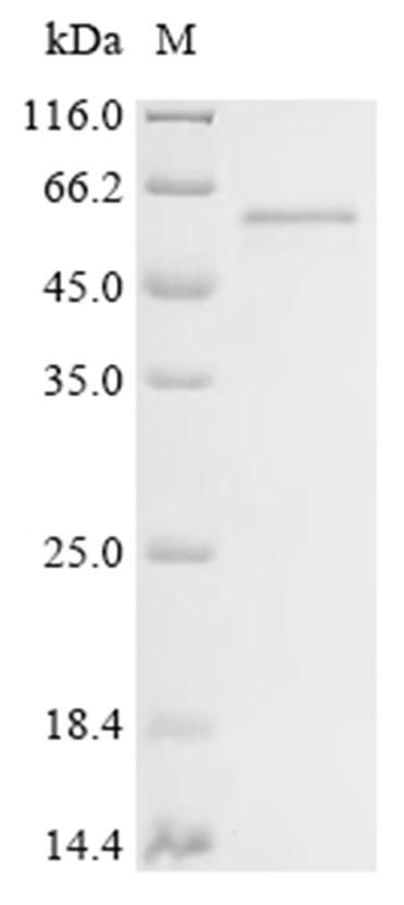 ATP2A2 Protein, Human, Recombinant (C-His)