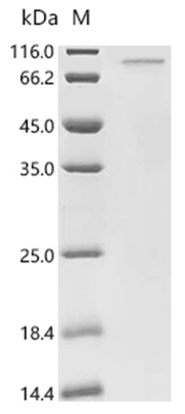 PARP12 Protein, Human, Recombinant (His & Myc)