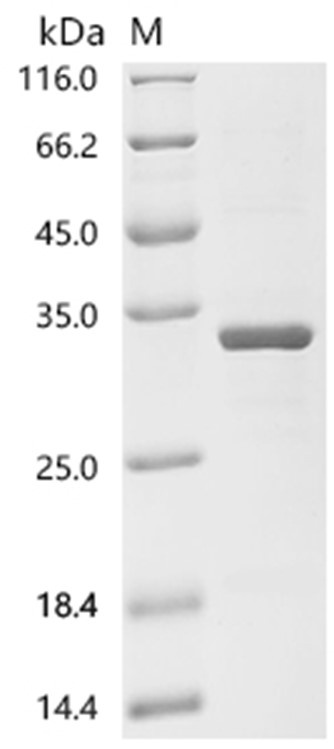 GDNF Protein, Human, Recombinant (His & SUMO)