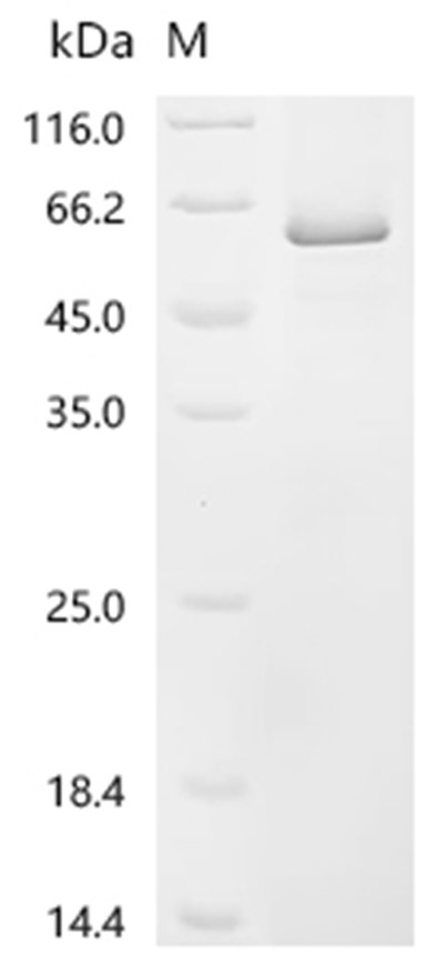 TEAD1 Protein, Human, Recombinant (His)