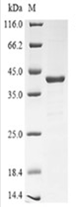 COL4A1 Protein, Human, Recombinant (GST)