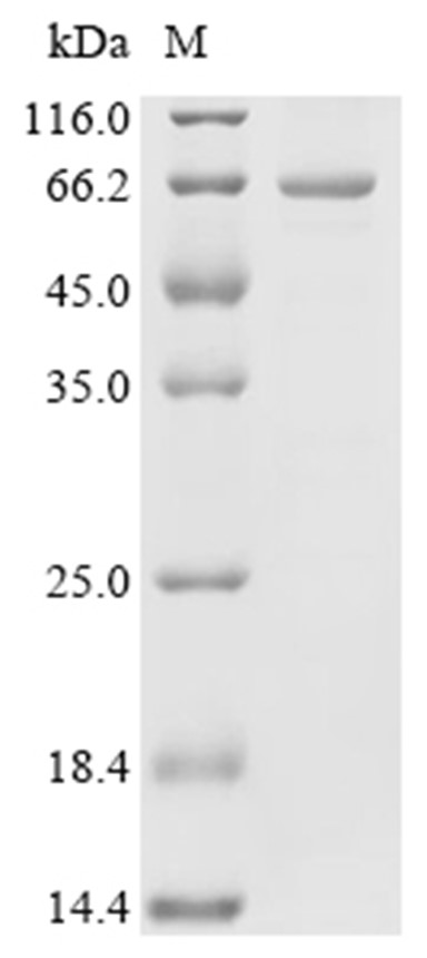 RAE1 Protein, Human, Recombinant (GST)