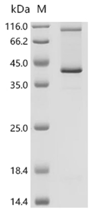 C5AR1 Protein, Human, Recombinant (Cell-Free, His)