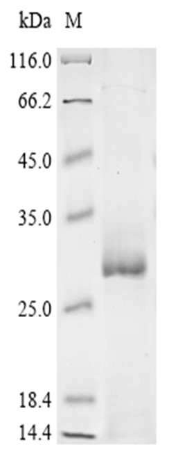 CHRNG Protein, Human, Recombinant (E. coli, His)