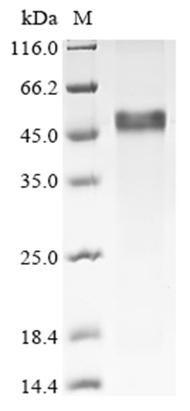 VCAN Protein, Human, Recombinant (B2M & His & Myc)