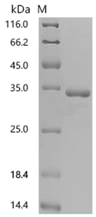 ODAM Protein, Human, Recombinant (His)