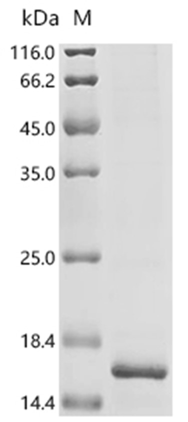 AGTR1 Protein, Human, Recombinant (His & Myc)