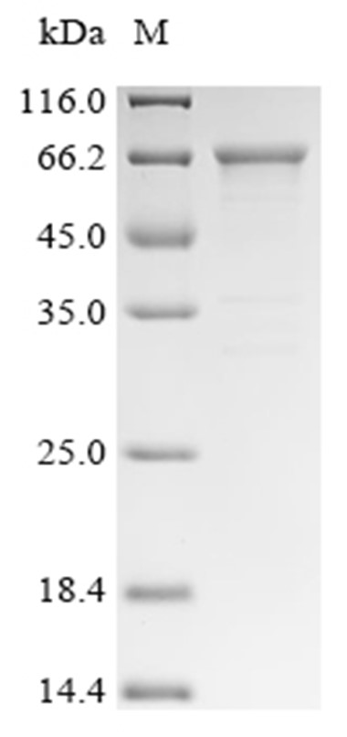KRT1 Protein, Human, Recombinant (His)