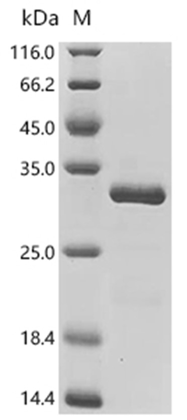 Pal Protein, Pasteurella multocida, Recombinant (His & SUMO)