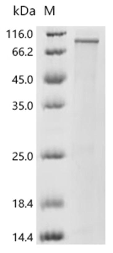 CLINT1 Protein, Human, Recombinant (His)