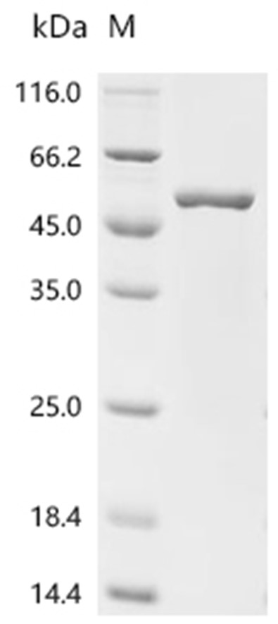 Serine racemase/SRR Protein, Human, Recombinant (His & SUMO)
