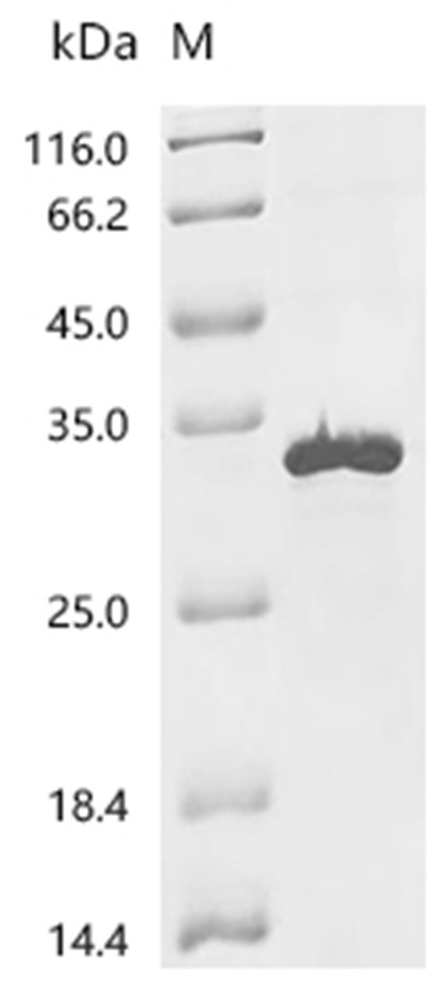 SOSTDC1 Protein, Mouse, Recombinant (His & Myc)